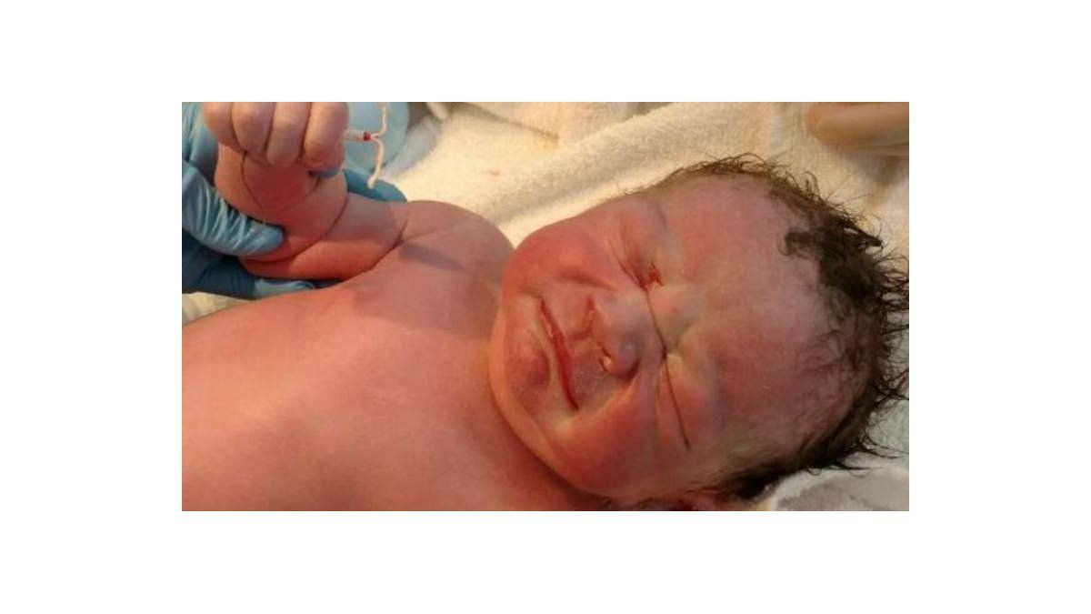 Método Anticonceptivo Fallido Nació Bebé Con El Diu En La Mano 4631