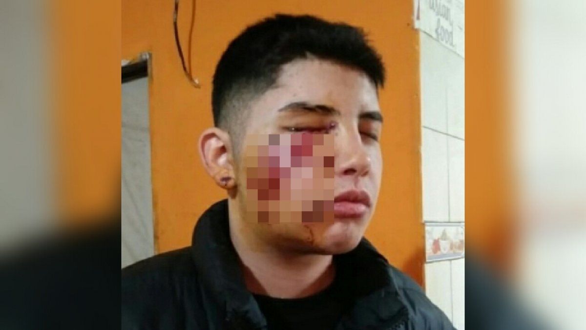 Ignacio Seijas fue baleado en su ojo derecho y perdi&oacute; la visi&oacute;n del mismo tras un allanamiento por error en su casa de Villa Albertina, en Lomas de Zamora.