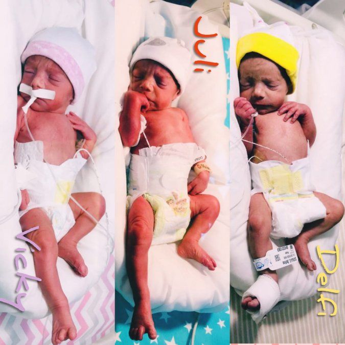 Victoria, Julieta y Delfina, las trigemelas de Lomas de Zamora, pocos instantes despu&eacute;s de su nacimiento.