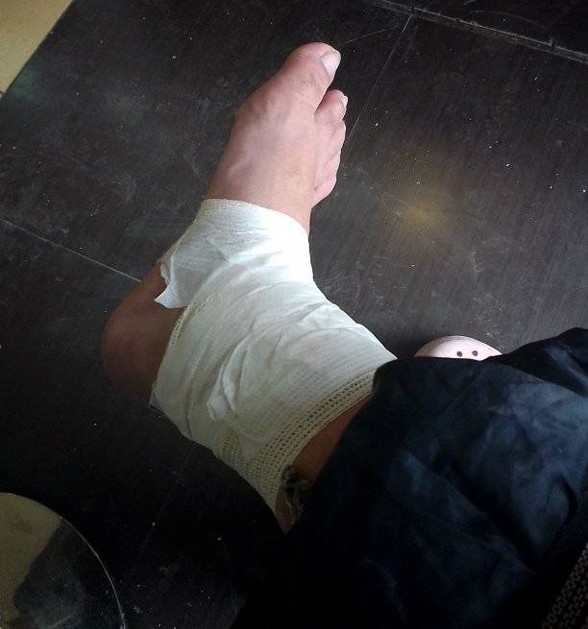 Emilia sufrió un esguince tras una caída en el viaje de regreso.