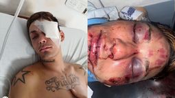 adrogue: un detenido tras una brutal golpiza a la salida de un boliche