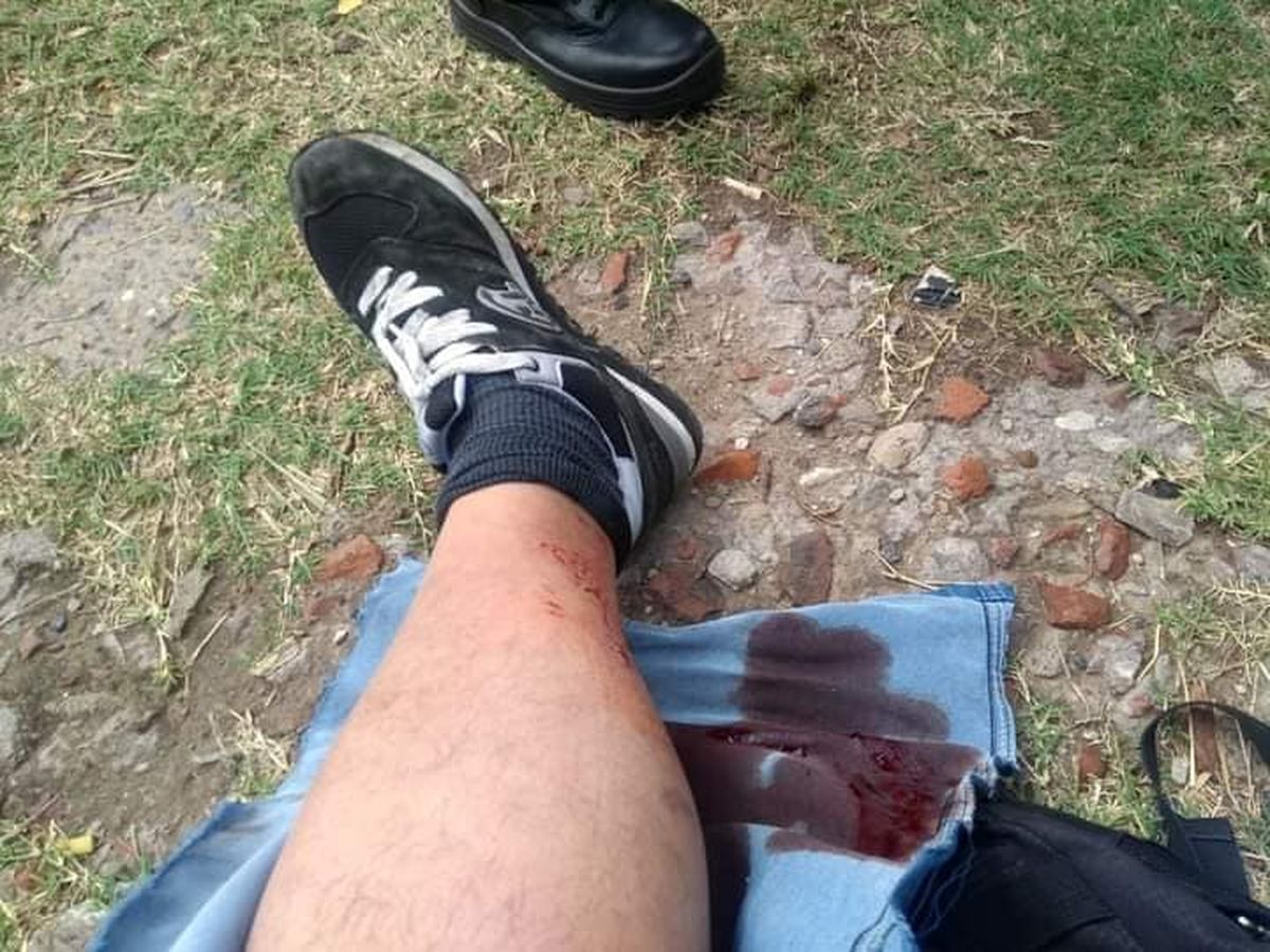 El polic&iacute;a result&oacute; herido en una pierna, fuera de peligro, mientras que el delincuente falleci&oacute; en el Hospital Gandulfo de Lomas de Zamora.