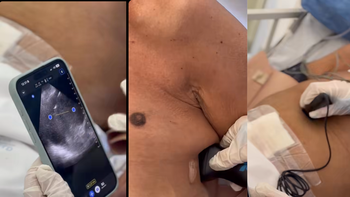 Ezeiza: suman equipamiento para estudios en el Hospital Eurnekian