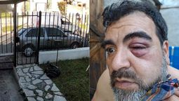 brutal agresion en almirante brown: un hombre sufrio fracturas en la cara tras una discusion de transito