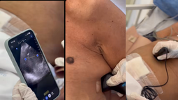 ezeiza: suman equipamiento para estudios en el hospital eurnekian