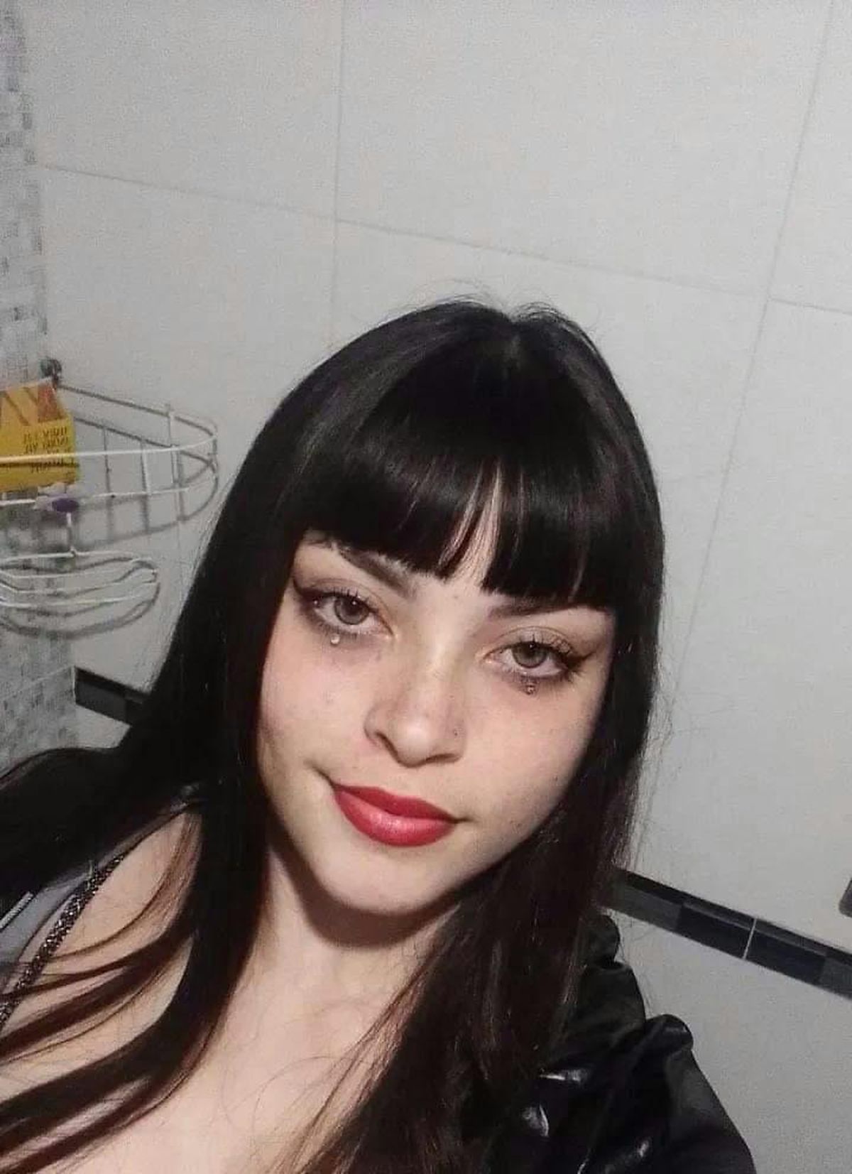 La joven de Esteban Echeverr&iacute;a ten&iacute;a 15 a&ntilde;os al momento del siniestro. Espera una nueva cirug&iacute;a para los pr&oacute;ximos meses.