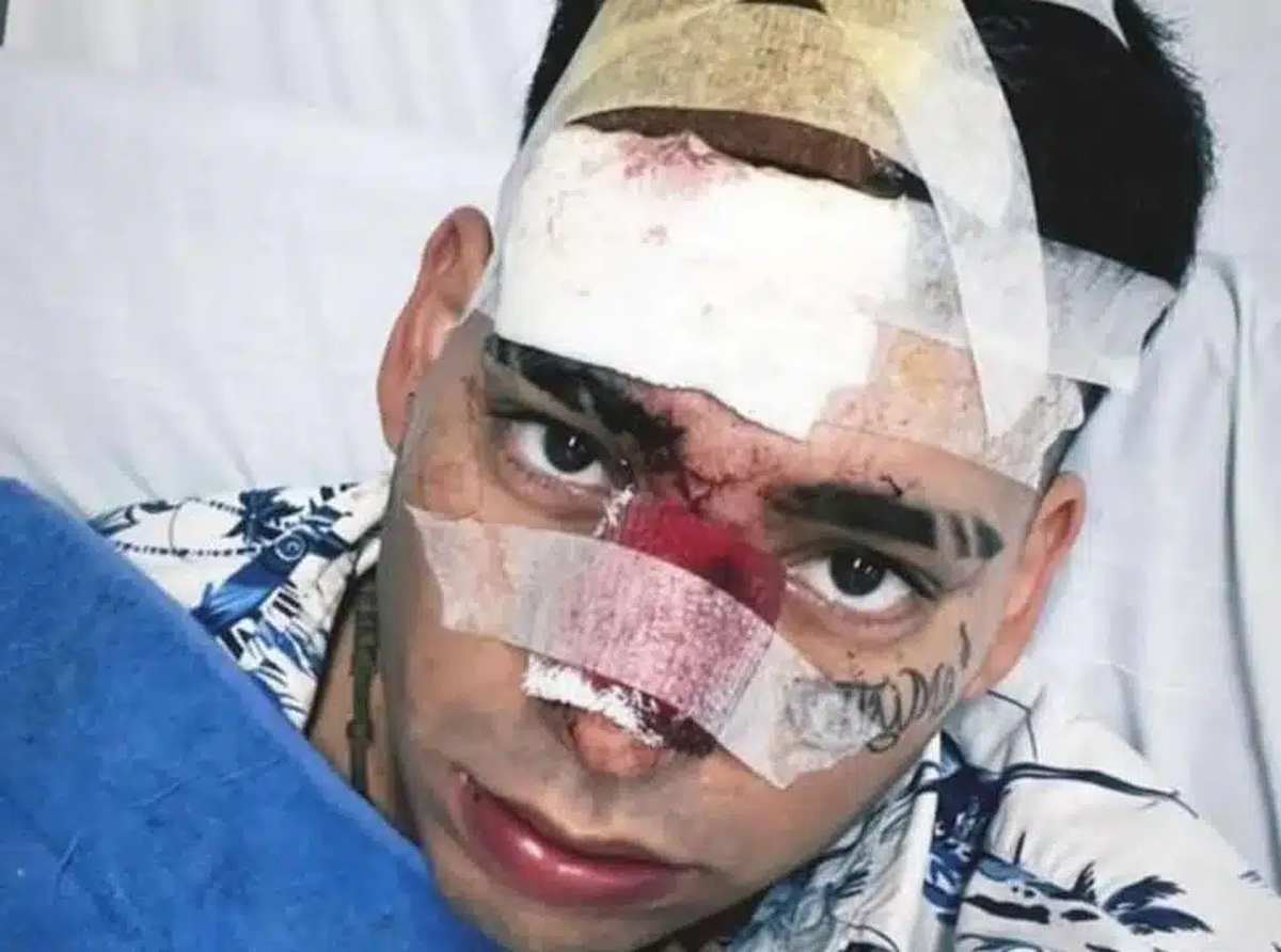 El cantante ya había sufrido un accidente en la autopista.