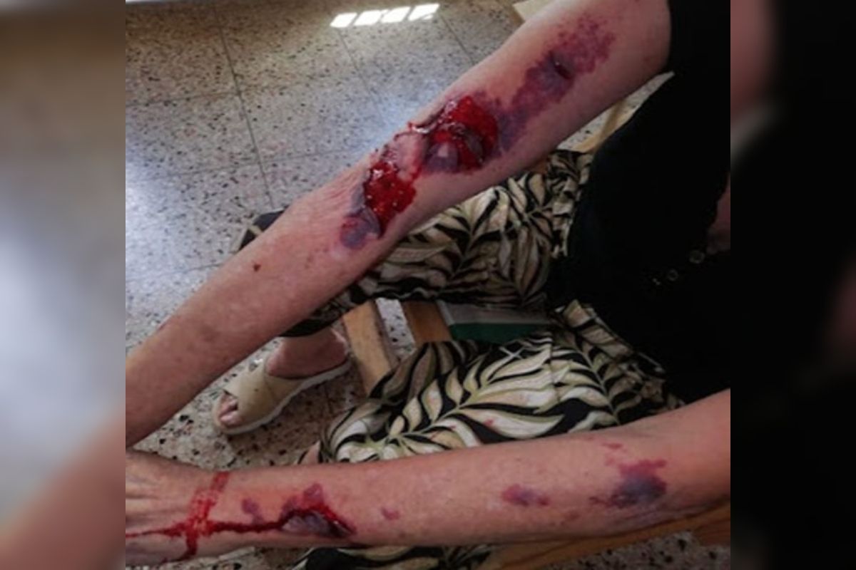 Así golpearon los motochorros a la vecina de Lanús. 