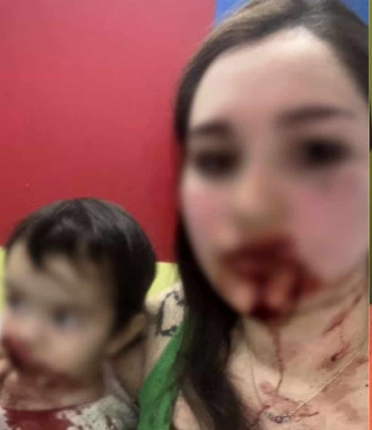 La hija fue internada de urgencia. La hija fue internada de urgencia.