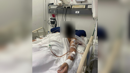 lomas: golpearon a un adolescente en la cabeza para robarle y esta muy grave
