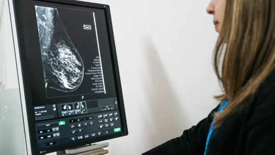 Lomas de Zamora: harán mamografías y controles gratuitos para mujeres