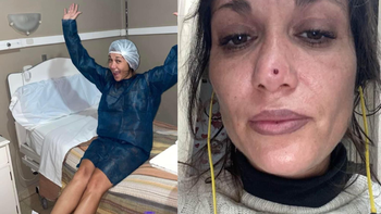 Nueva víctima de Lotocki atendida en Lomas: Me salió pus en la cola y se me infectó la nariz