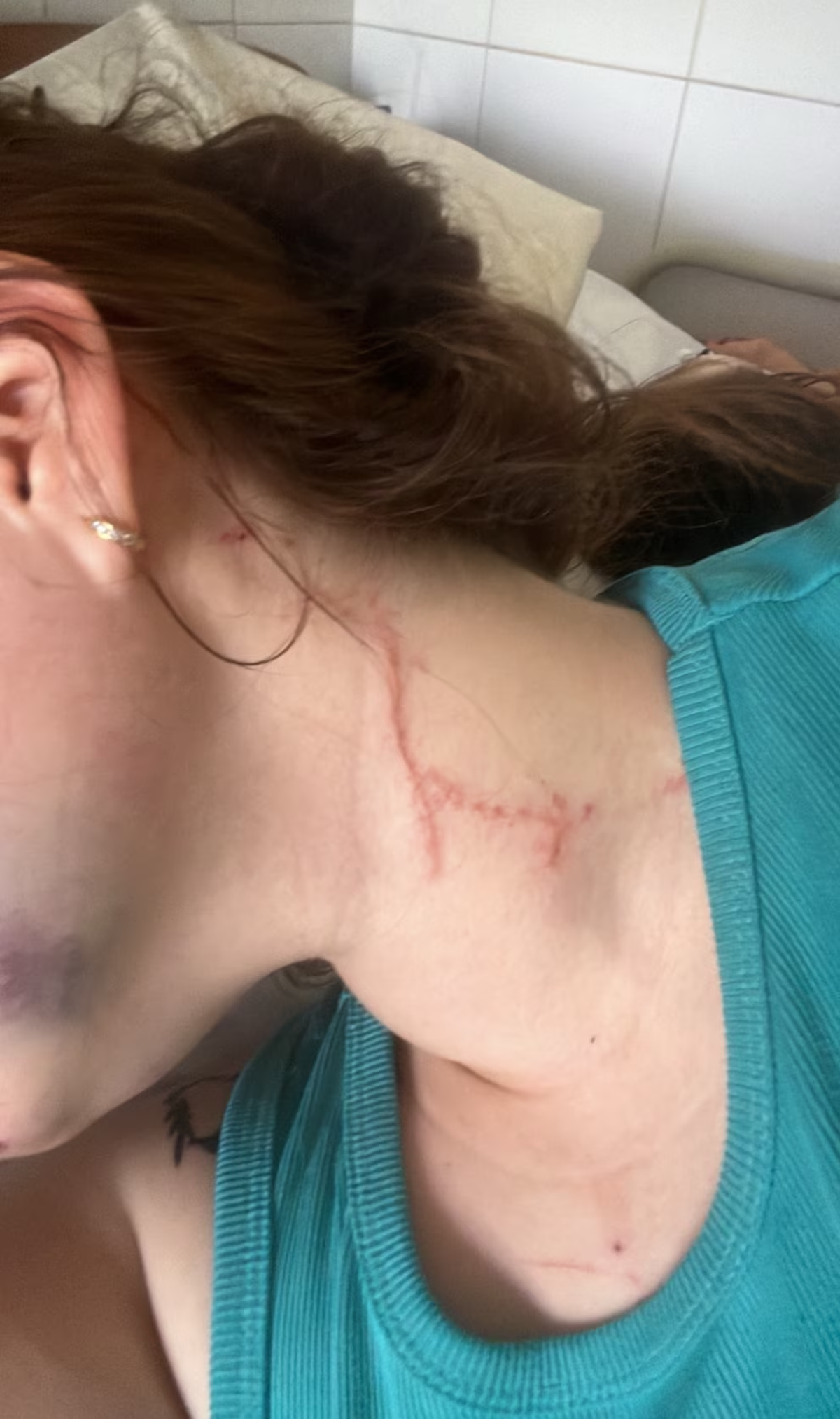 La v&iacute;ctima de Solano mostr&oacute; las heridas en su cuello.