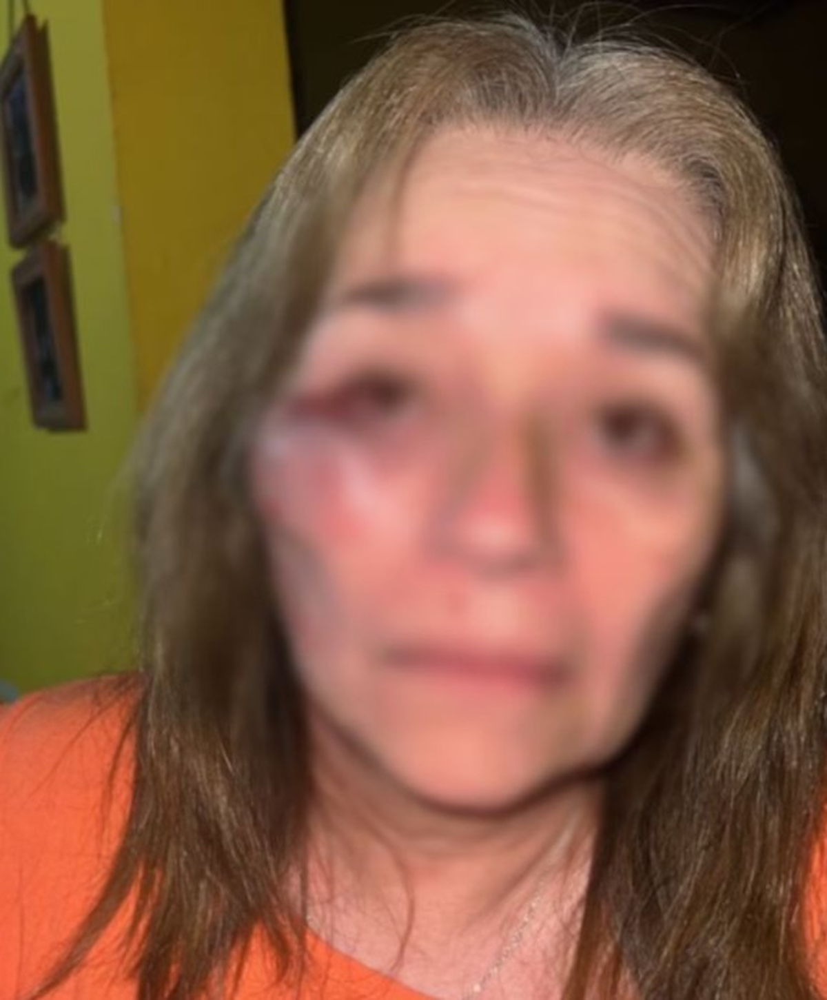 La madre tiene que ser operada por el fuerte golpe. La madre tiene que ser operada por el fuerte golpe.