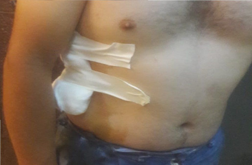 Intento de asalto a un delivery en San Vicente: lo hirieron con una bala de goma
