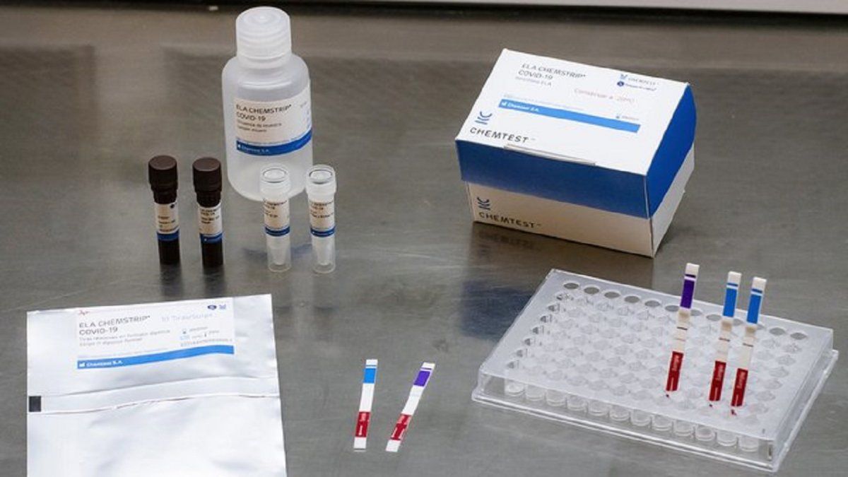 Nuevo test para detectar coronavirus desarrollado por universidades públicas.