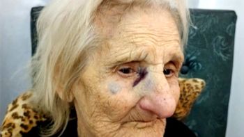 Violento robo en Lanús: tres delincuentes atacaron a una jubilada de 93 años