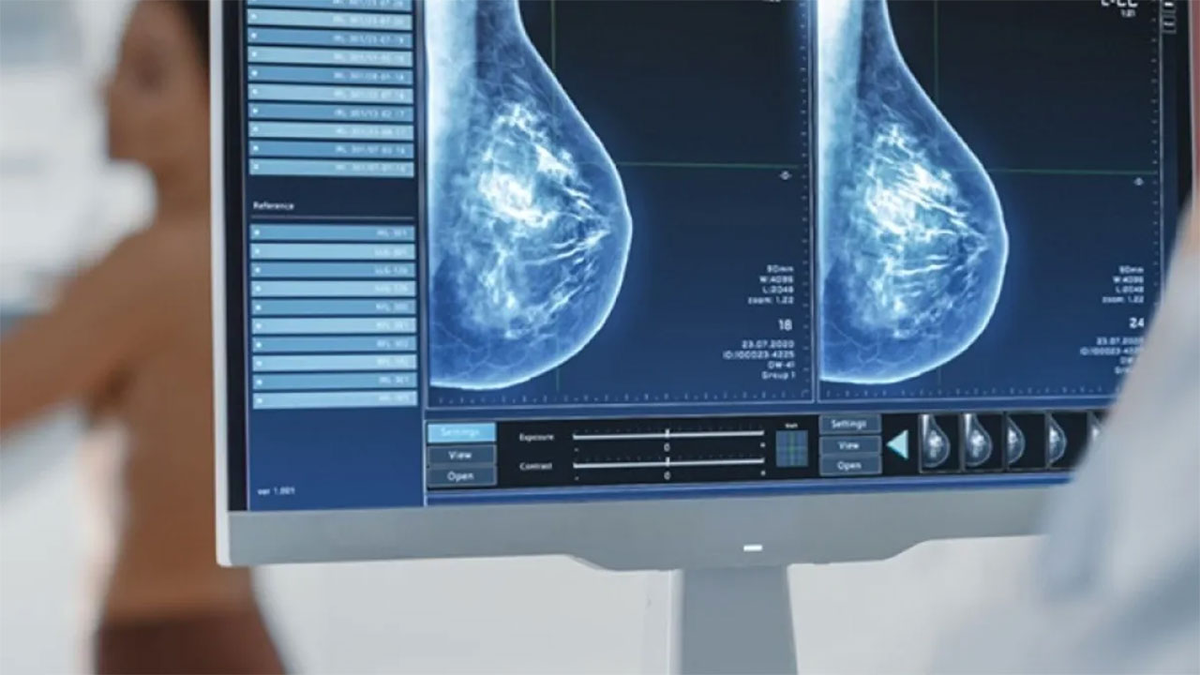 Las mamografías se realizarán en dos centros de salud de Lomas de Zamora.