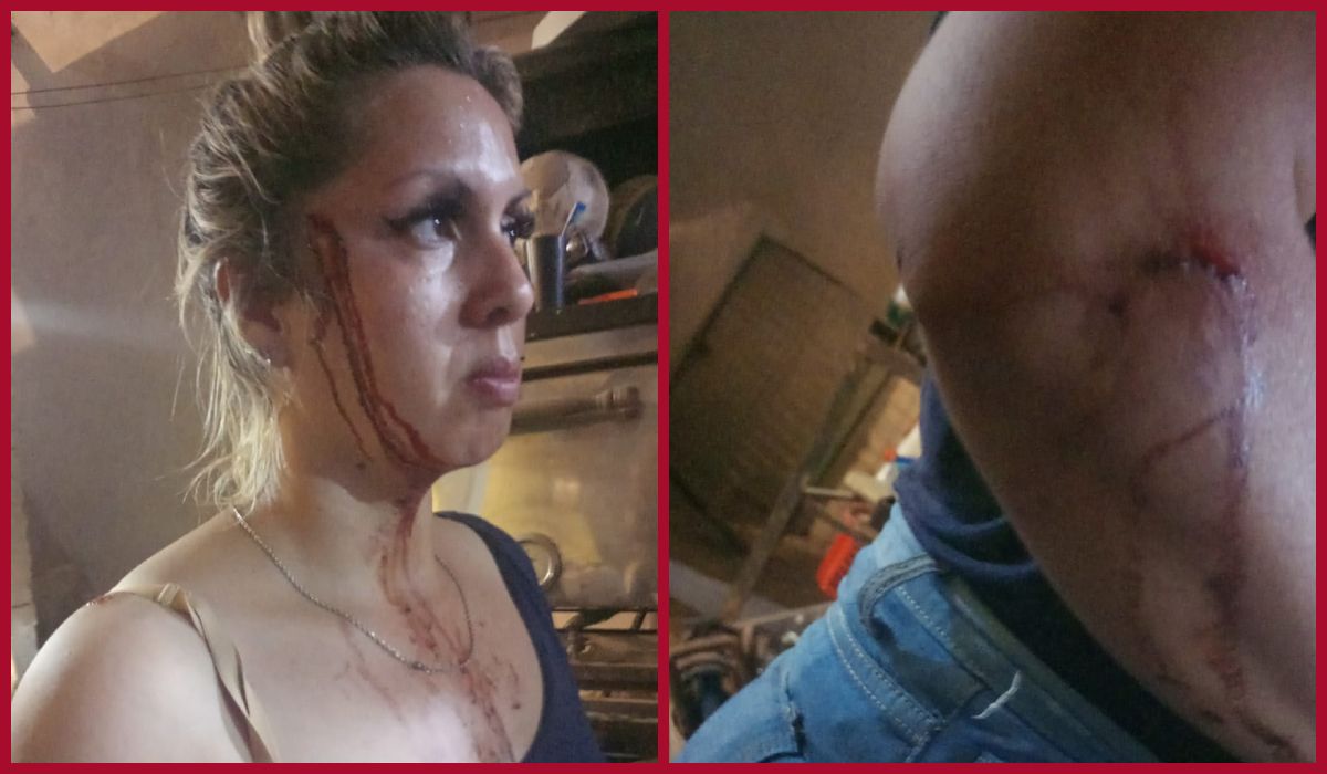 Apuñalaron a una mujer durante una pelea vecinal en Lanús.