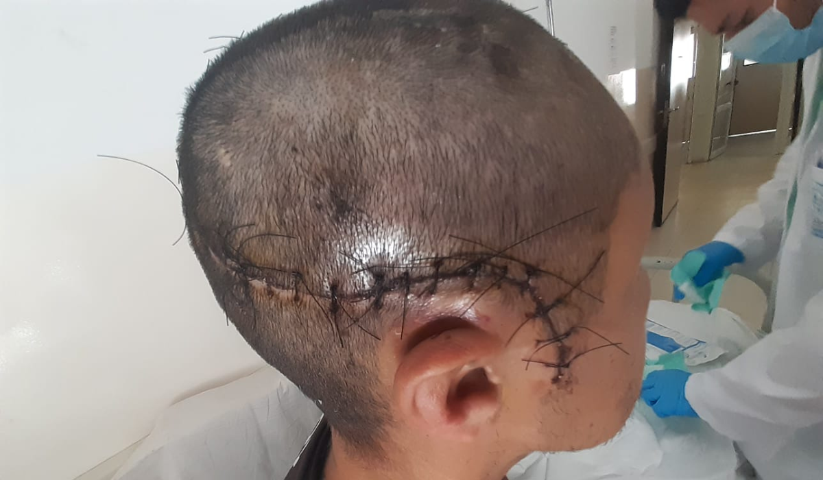 Terrible accidente filmado en Ezeiza: lo atropelló un colectivo y perdió parte del cráneo