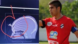 realizaran una colecta para ayudar al ex jugador de claypole atacado con una llave de auto en la cabeza