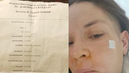 la lucha de una vecina de san vicente con un tumor facial: organizan un festival solidario para ayudarla