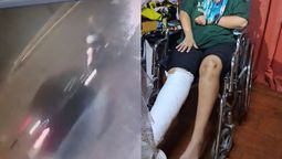 piden colaboracion para nair, la joven atropellada en longchamps, que debe operarse: necesitamos 6 millones