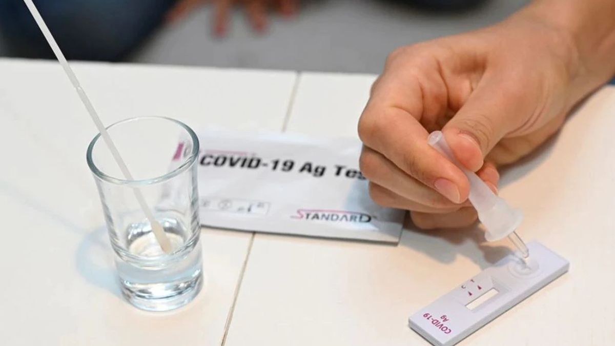 Aprobaron el uso de autotest de coronavirus.