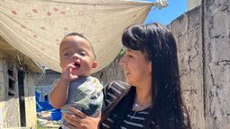 lomas: tiene un ano, fue diagnosticado con craneosinostosis y su familia organizo una colecta solidaria