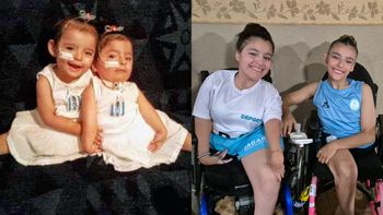 Almirante Brown: nacieron siamesas