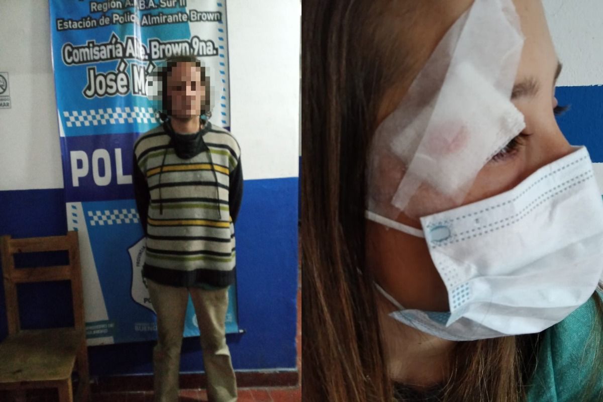 Peligro en Adrogué: joven fue atacada por un hombre en situación de calle