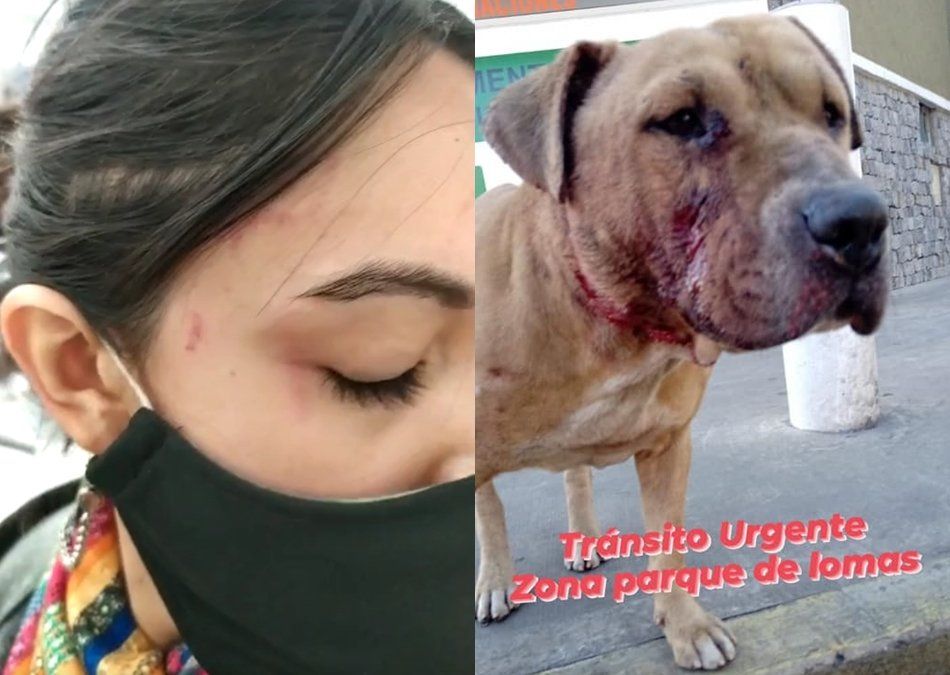Los golpes en la cara de Sofía y las terribles heridas que sufrió el perro que intentó defender. Parque Barón, Lomas de Zamora.