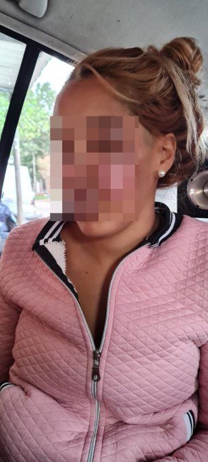La víctima quedó con el rostro desfigurado tras la agresión que sufrió en Ingeniero Budge.