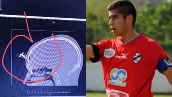 Realizarán una colecta para ayudar al ex jugador de Claypole atacado con una llave de auto en la cabeza