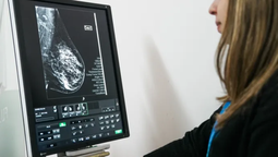 lomas de zamora: haran mamografias y controles gratuitos para mujeres