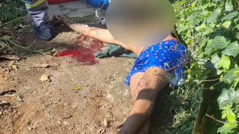 Un herido y un prófugo tras un tiroteo en Quilmes