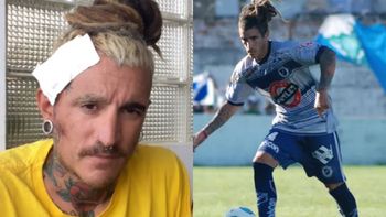 Ex jugador de San Martín de Burzaco sobrevivió a un accidente en Ecuador y pide ayuda para volver al país