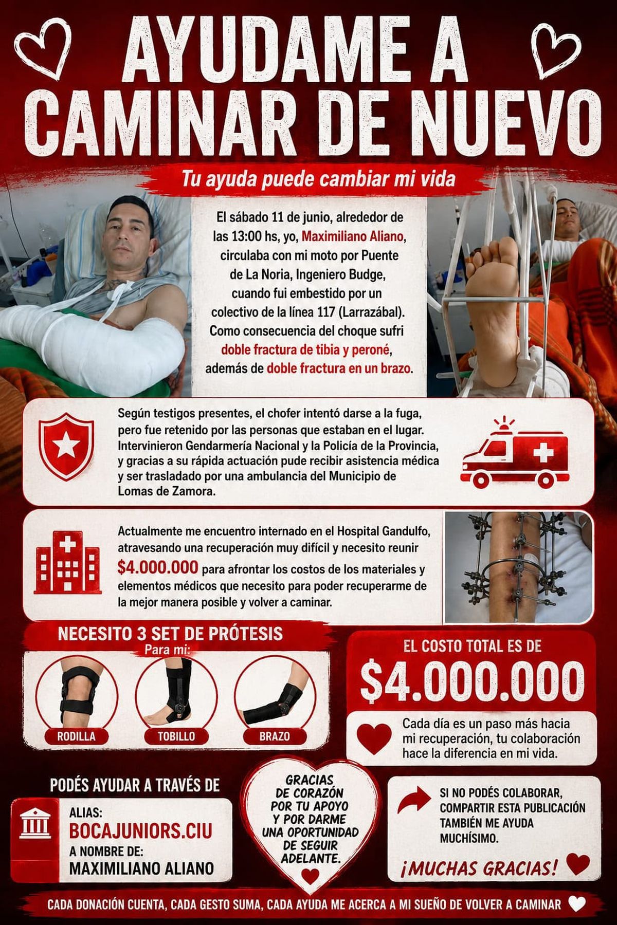Alejandra, madre de Maximiliano, pidió colaboración para afrontar el costo de las prótesis que permitirán realizar la cirugía y comenzar la rehabilitación. Alejandra, madre de Maximiliano, pidió colaboración para afrontar el costo de las prótesis que permitirán realizar la cirugía y comenzar la rehabilitación.